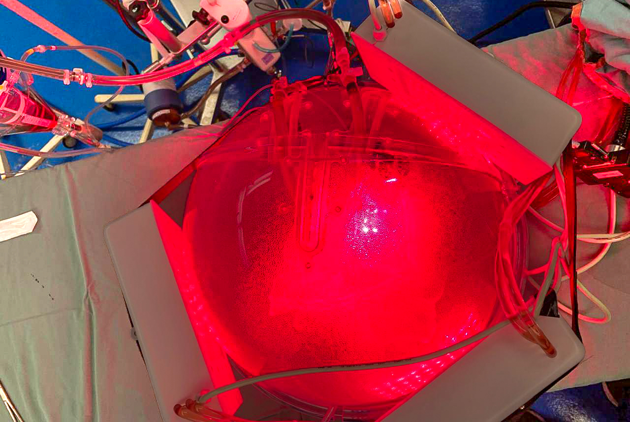 Un ‘gemelo digital’ del tórax simula la aplicación de luz para el tratamiento de neumonías