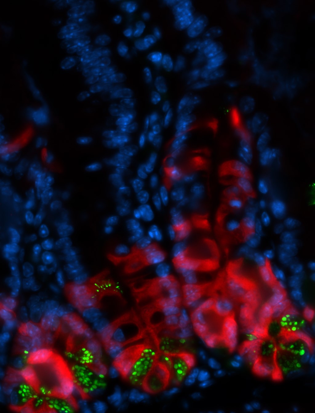 Análise histológica do epitélio intestinal usada para quantificar a atividade das células-tronco em diferentes condições de alimentação. Em vermelho, as células-tronco e as células progenitoras (geradas pelas células-tronco) após administração de um reagente específico em camundongos. Um maior número de células vermelhas indica uma maior taxa de proliferação das células-tronco. Em verde, as células de Paneth que desempenham funções de auxílio e proteção às células-tronco (imagem: Renan Corrêa)