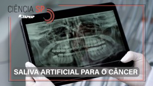 Ciência SP | Saliva artificial protege dentes de pacientes com câncer