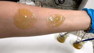 Ciência SP | Curativo aumenta a eficácia do tratamento de feridas cutâneas