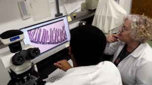 Ciência SP | Muita frutose eleva risco de diabetes e problemas no fígado