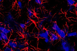 Insulin resistance in the brain may be one of the factors linking Alzheimer’s disease and epilepsy