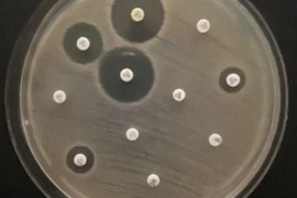 Bactérias detectadas em rio urbano, cão doméstico e lesões de pele ressaltam risco da multirresistência microbiana