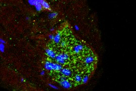 Estrutura que controla a pressão arterial também age como ‘radar’ de inflamação