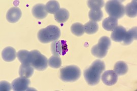 Anti-cancer molecules show promise in the fight against malaria