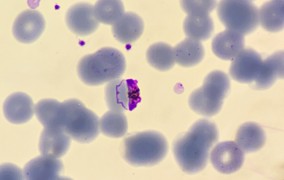 Anti-cancer molecules show promise in the fight against malaria