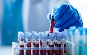 Biorrepositório brasileiro pode ajudar a personalizar a prevenção do câncer no SUS