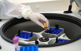 Marcadores no sangue podem prever eficácia de imunoterapia contra melanoma avançado