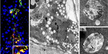 SARS-CoV-2 infecta células dos testículos e usa seus recursos para se multiplicar