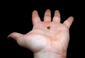 Less than 7 mm in length, this Atlantic Rainforest flea toad is the second-smallest vertebrate described in the world