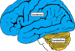 Cerebellar atrophy in epilepsy patients is linked to the disease, not to medication use, says study