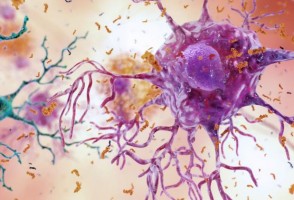 Inflamação no cérebro induzida por dieta rica em gordura atrai células imunes de todo o corpo