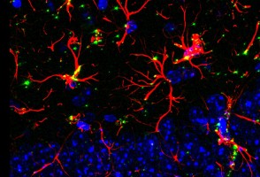 Molecule reverses cognitive deficits associated with aging and dementia in animal tests