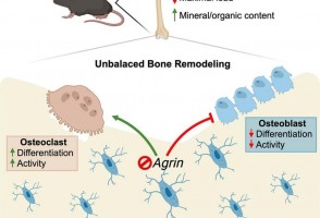 Researchers identify protein essential for balancing bone tissue