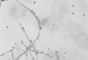 New center will study endemic fungal diseases in Latin America
