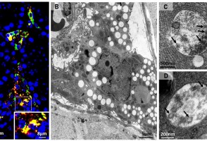SARS-CoV-2 infecta células dos testículos e usa seus recursos para se multiplicar