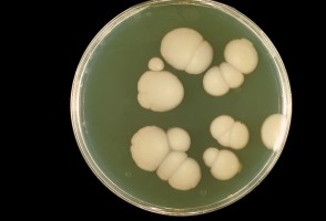 Terapia a laser potencializa tratamento contra fungo resistente a medicamento convencional