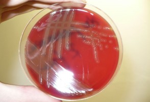 Estudo analisa mecanismo de resistência de bactéria causadora de pneumonia e meningite
