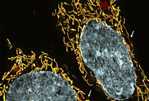 Research reveals possibility of new drug therapy for hereditary diseases