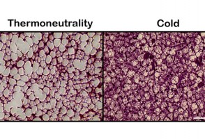 Study paves the way for new therapeutic strategies against obesity