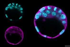 Research reveals new functions of two proteins for cell function and renewal