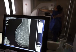 Medo, dor, vergonha e desigualdades afastam mulheres do rastreamento do câncer de colo do útero e de mama