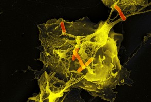 Neutrófilos adotam diferentes estratégias de defesa conforme o estímulo