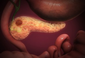 Estudio revela proteína vinculada al avance del cáncer de páncreas a lo largo de los nervios