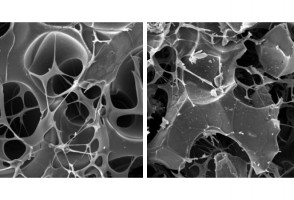 ‘Andaime’ de grafeno recruta células ósseas e ajuda organismo a regenerar fratura