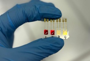 Biossensor identifica câncer de pâncreas em estágios iniciais