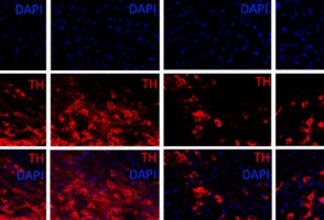 Molécula anti-inflamatória mostra potencial contra Parkinson em estudo com camundongos