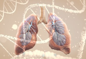 Estudio muestra que mutaciones en el gen <i>TP53</i> afectan la respuesta al tratamiento del cáncer de pulmón
