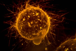 Cientistas descobrem possível forma de desativar mecanismo de progressão do câncer