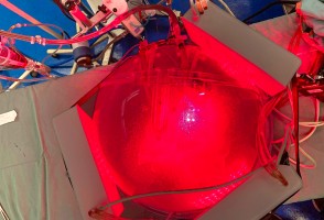 ‘Gêmeo digital’ do tórax simula aplicação de luz para tratamento de pneumonias