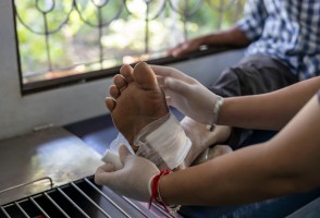 Nanopartícula combina duas estratégias para acelerar a cicatrização de feridas crônicas