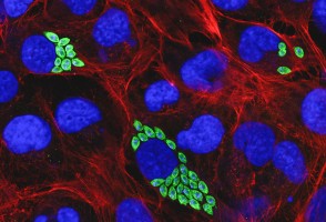 Proteína pouco conhecida é potencial alvo contra a doença de Chagas