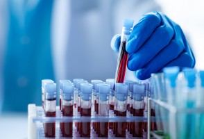 Biorrepositório brasileiro pode ajudar a personalizar a prevenção do câncer no SUS