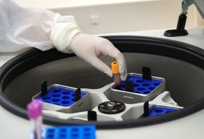 Marcadores no sangue podem prever eficácia de imunoterapia contra melanoma avançado