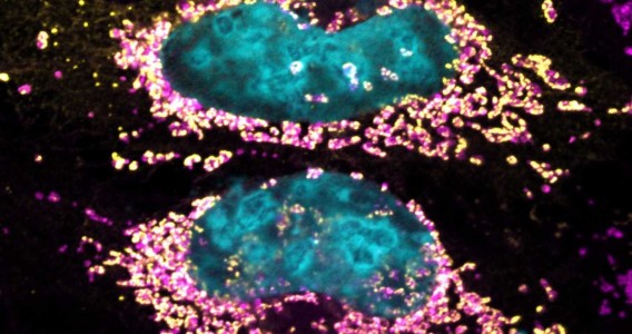 Estudo revela proteína bacteriana capaz de manter a célula humana saudável por mais tempo
