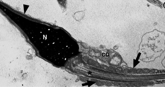 Vírus da COVID-19 pode permanecer no espermatozoide até 110 dias após a infecção