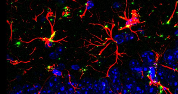 Molécula reverte déficit cognitivo associado ao envelhecimento e à demência em testes com animais