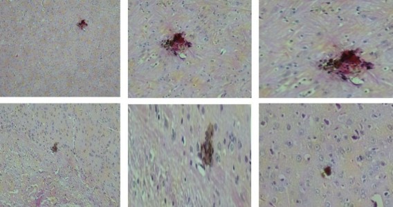 Vacina contra o vírus zika mostra resultados promissores em testes com camundongos
