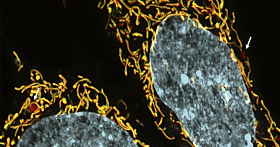 Research reveals possibility of new drug therapy for hereditary diseases