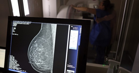 Medo, dor, vergonha e desigualdades afastam mulheres do rastreamento do câncer de colo do útero e de mama