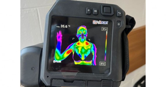 The ‘yo-yo effect’ impairs metabolism and reduces brown fat activity in women