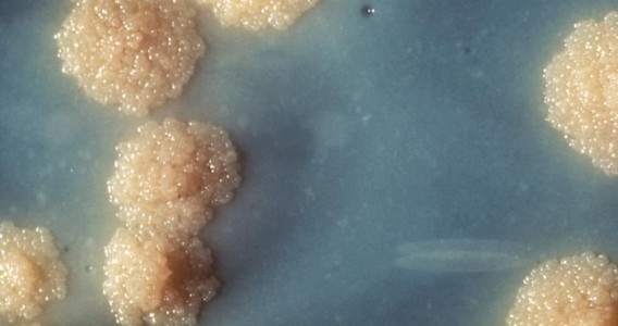 Nanopartícula com ferro elimina tuberculose em camundongos e pode abrir caminho para novos tratamentos