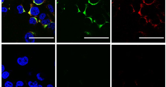 Cientistas usam ultrassom para estourar vírus da influenza A e da COVID-19 sem danificar células humanas