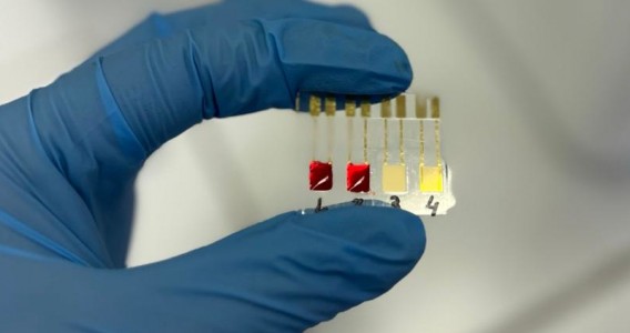 Biossensor identifica câncer de pâncreas em estágios iniciais