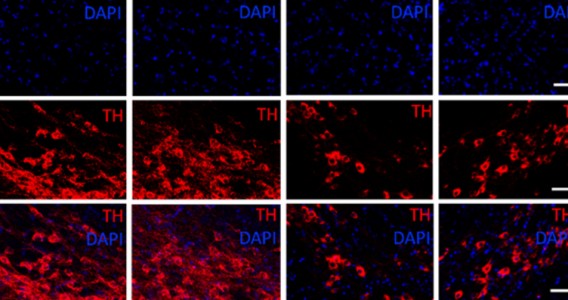 Molécula anti-inflamatória mostra potencial contra Parkinson em estudo com camundongos