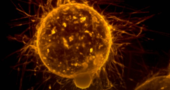 Cientistas descobrem possível forma de desativar mecanismo de progressão do câncer